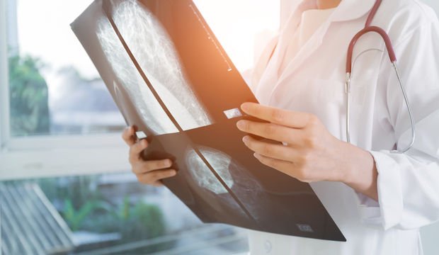 Mamografi kalp hastalıklarından koruyabilir mi?