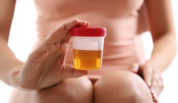 İdrarın rengi ve kokusu nasıl olmalı?