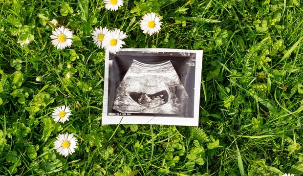 Dilay'ın gebelik günlüğü: 8. hafta