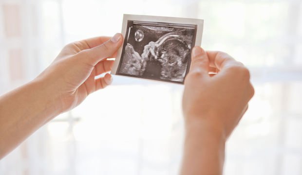 Dilay'ın gebelik günlüğü: 11. hafta