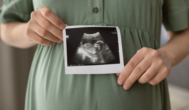 Dilay'ın gebelik günlüğü: 18. hafta