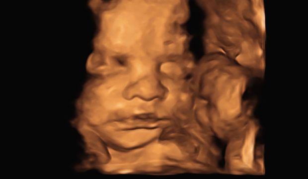 Dilay'ın gebelik günlüğü: 21. hafta