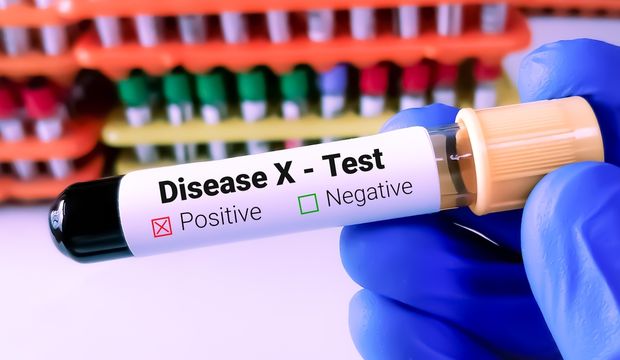 X hastalığı nedir? X hastalığı belirtileri nelerdir?