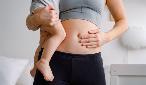Brezilya’da sezaryen oranlarını düşürmek için kampanya düzenleniyor