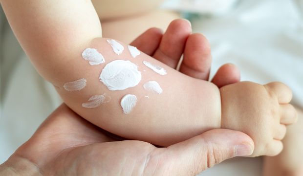 Bebeklerde ve çocuklarda güneş yanığı nasıl rahatlatılır?
