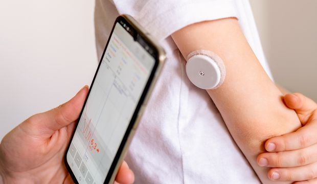 Sensörlü cilt altı glukoz izlem cihazlarını SGK karşılıyor mu?