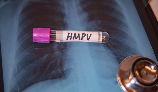 HMPV virüsü nedir?