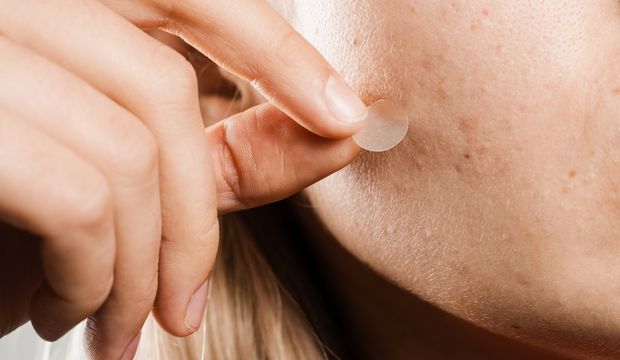 Sivilce bantları işe yarıyor mu?