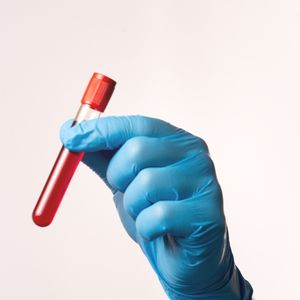 Yeni bir kan testi, kanseri tarama öncesi belirliyor