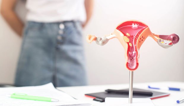 Polikistik Over Sendromu (PKOS) belirtileri nelerdir? 